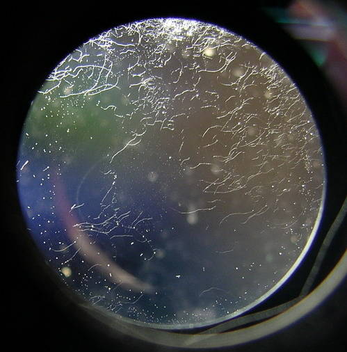 Lens fungus